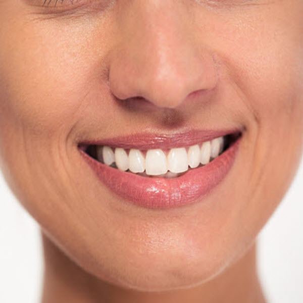 Month2_Article2 Teeth whitening