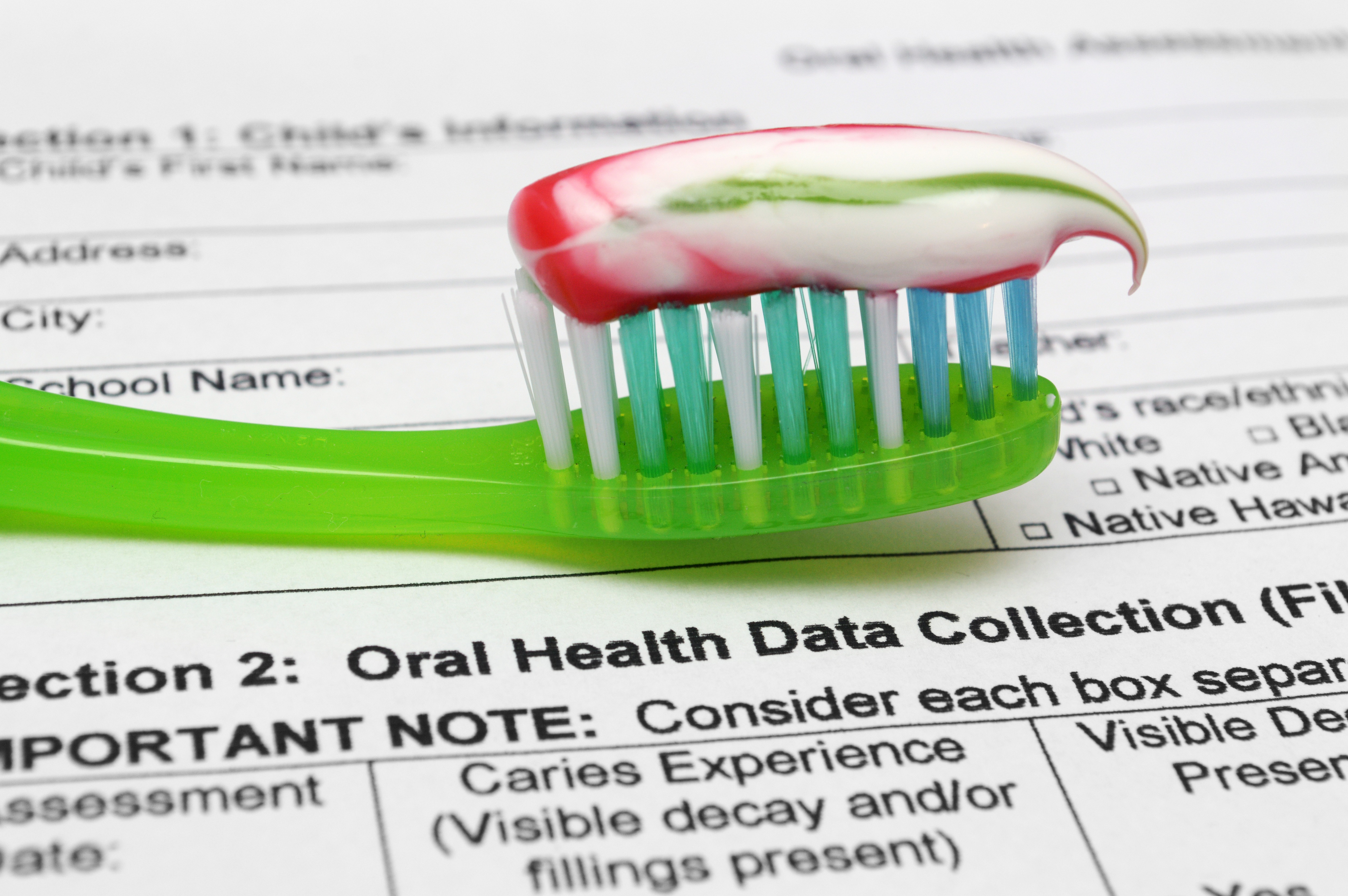 Oral health teeth whitening