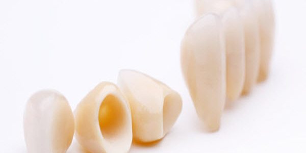Month5_Article2 Dental crowns