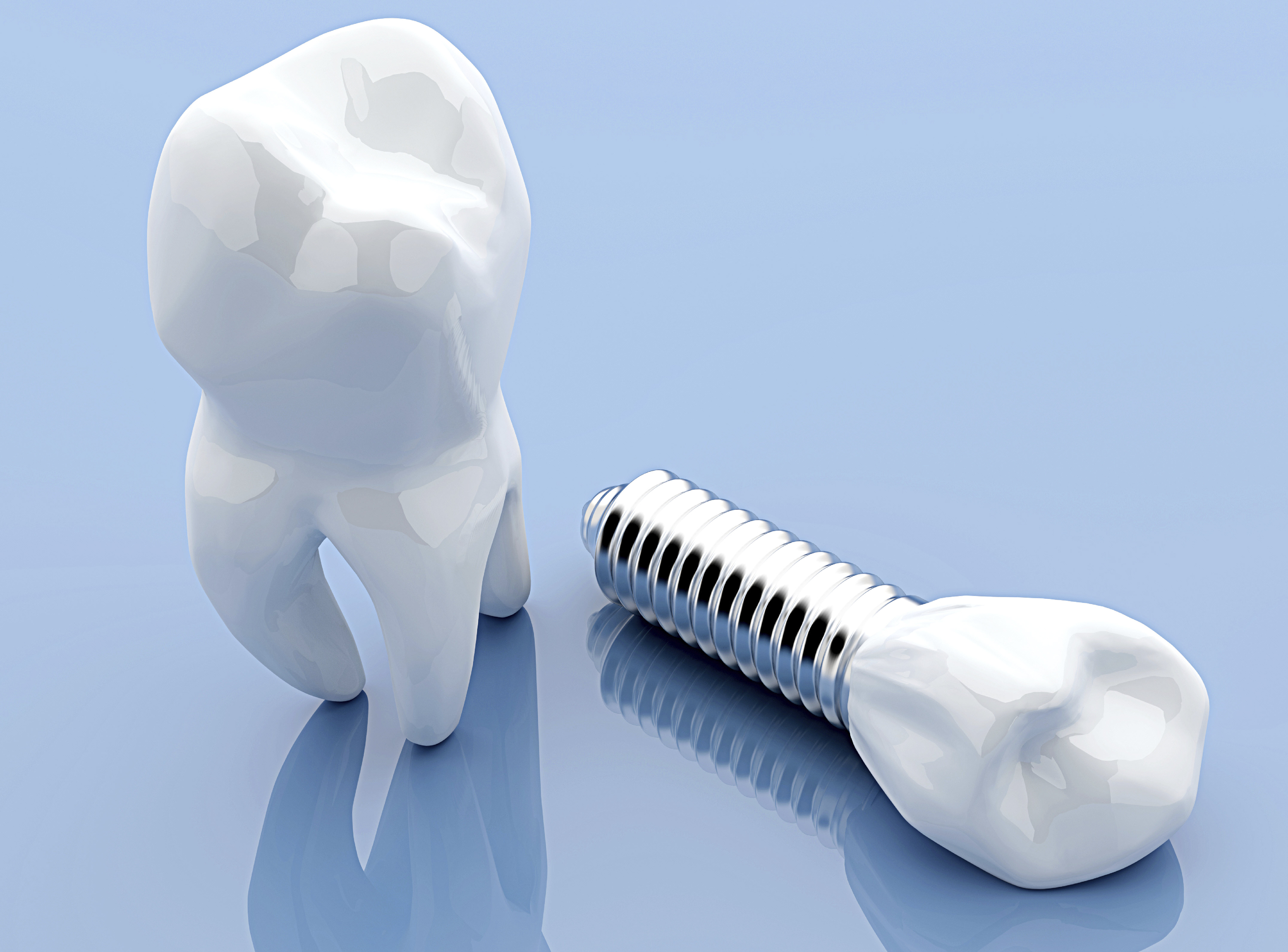 new_Month5_Article1 Dental implants