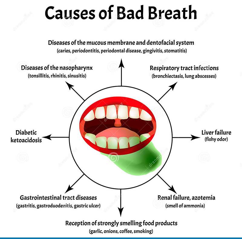6 Important points about Your Breath Health 6 Important points about Your Breath Health
