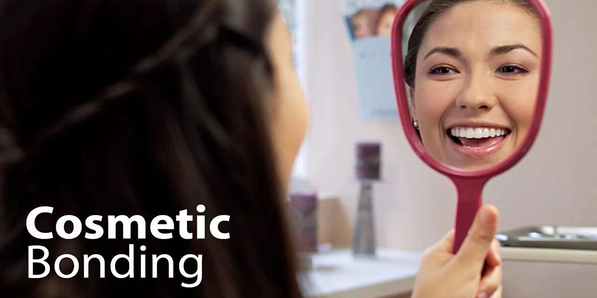 9 Reasons to have Dental Cosmetic Bonding done to your Teeth 2 9 Reasons to have Dental Cosmetic Bonding done to your Teeth 2