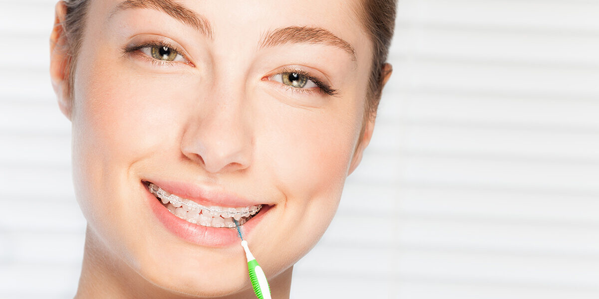 4 Tips for Interdental Teeth Brushing - The Secret To A Million-Dollar Smile 2