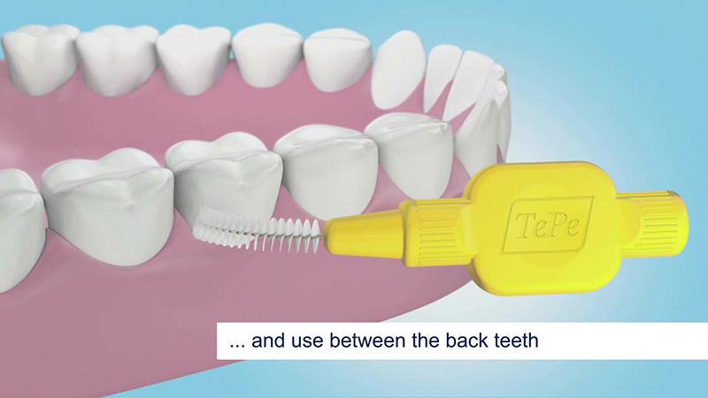 4 Tips for Interdental Teeth Brushing - The Secret To A Million-Dollar Smile 2