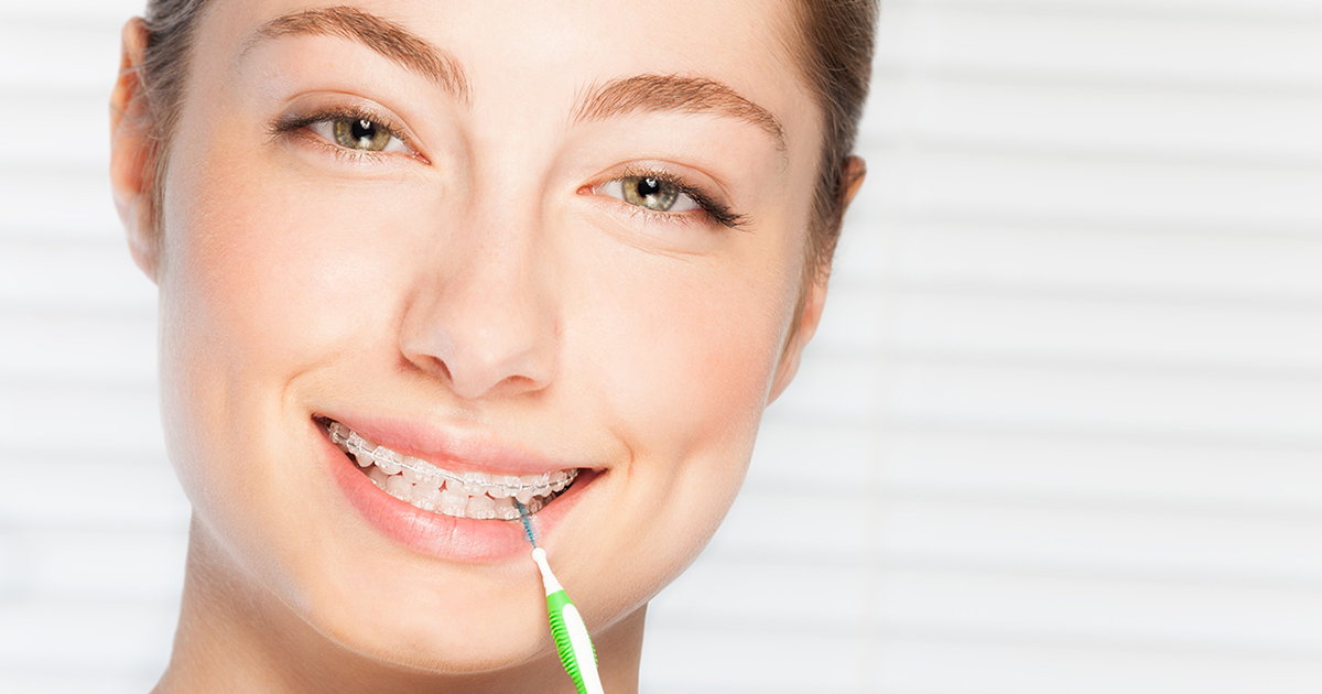 Woman cleaning teeth brace by interdental brush 4 Tips for Interdental Teeth Brushing - The Secret To A Million-Dollar Smile 2