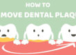3 best ways to remove Dental Plaque