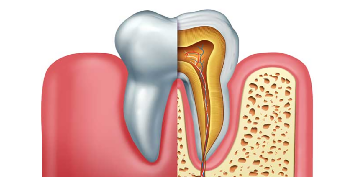 6 Important points about the Different Types of Dental Infections & treatments 6 Important points about the Different Types of Dental Infections & treatments