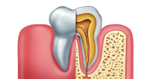 6 Important points about the Different Types of Dental Infections & treatments 6 Important points about the Different Types of Dental Infections & treatments