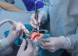 8 Types and Causes of Dental Surgeries 1