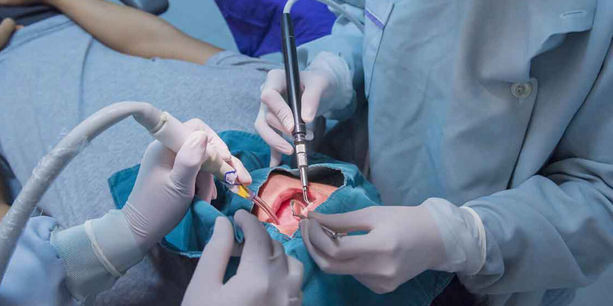 8 Types and Causes of Dental Surgeries 1 8 Types and Causes of Dental Surgeries 1