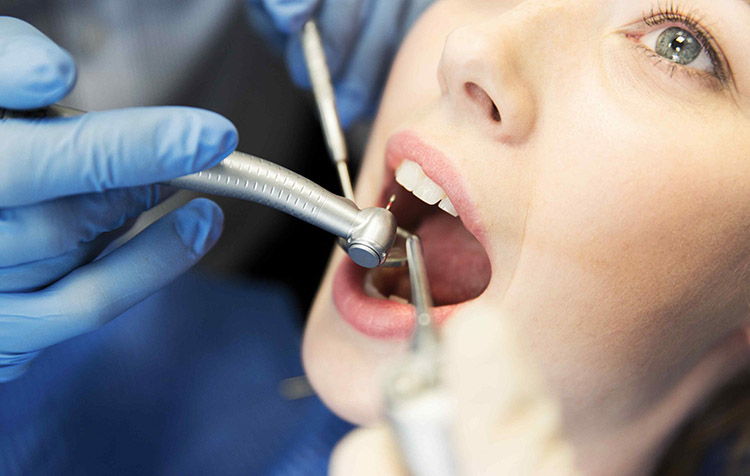8 Types and Causes of Dental Surgeries 2