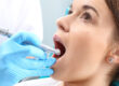5 Dental Root Canal Myths 2