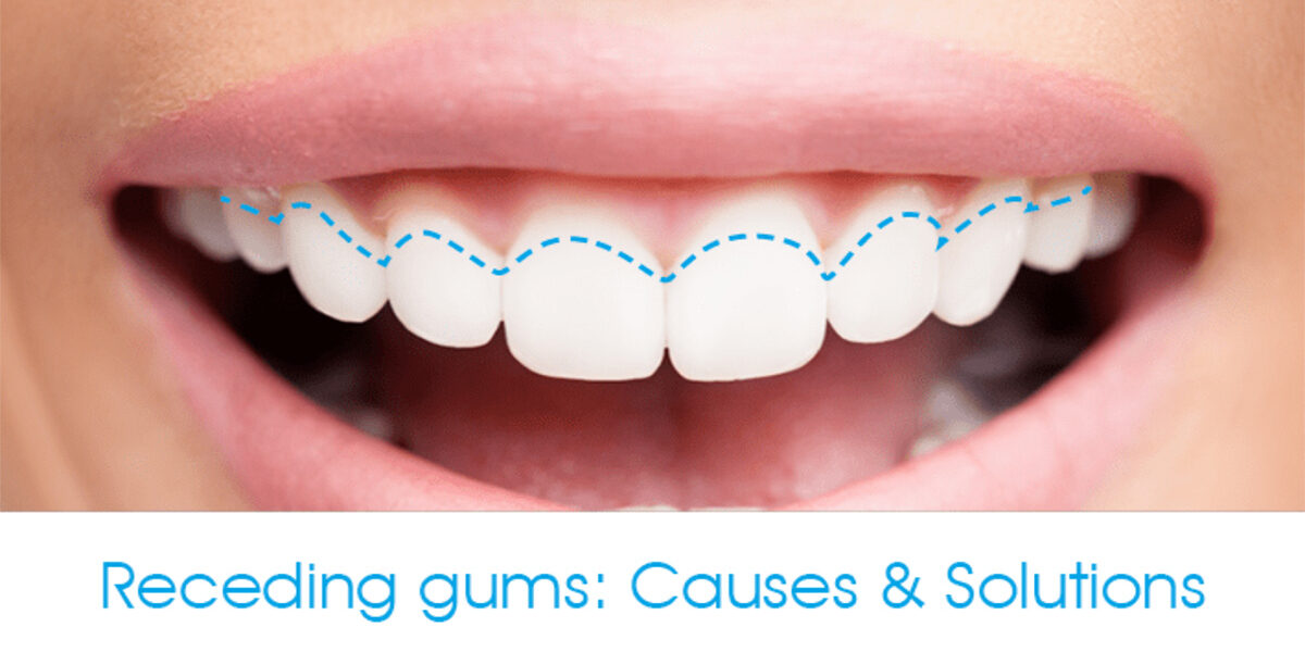 5 Signs that you have Gum Disease copy 5 Signs that you have Gum Disease copy