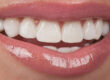 5 best ways dental cosmetics can improve your smile