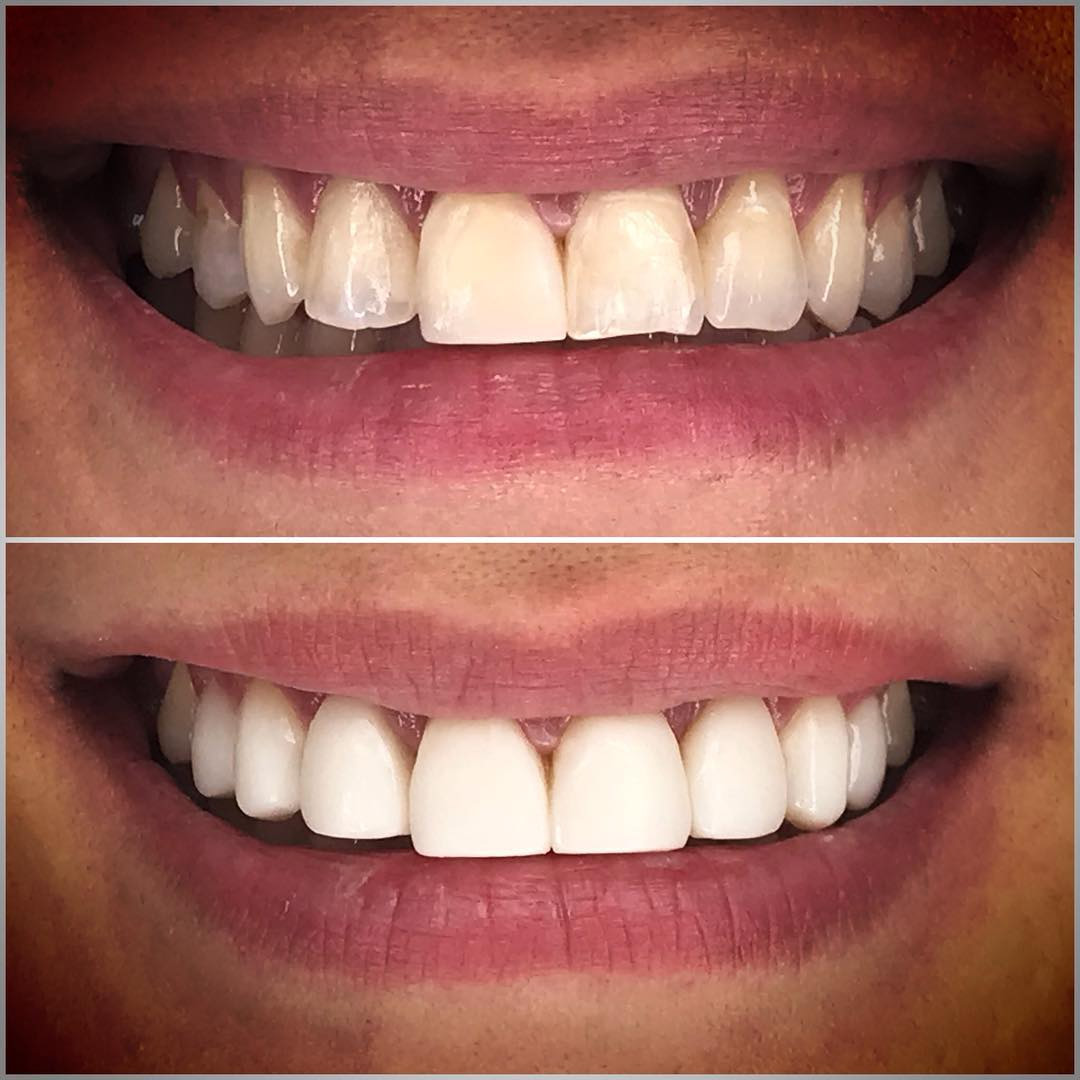 5 best ways dental cosmetics can improve your smile 2