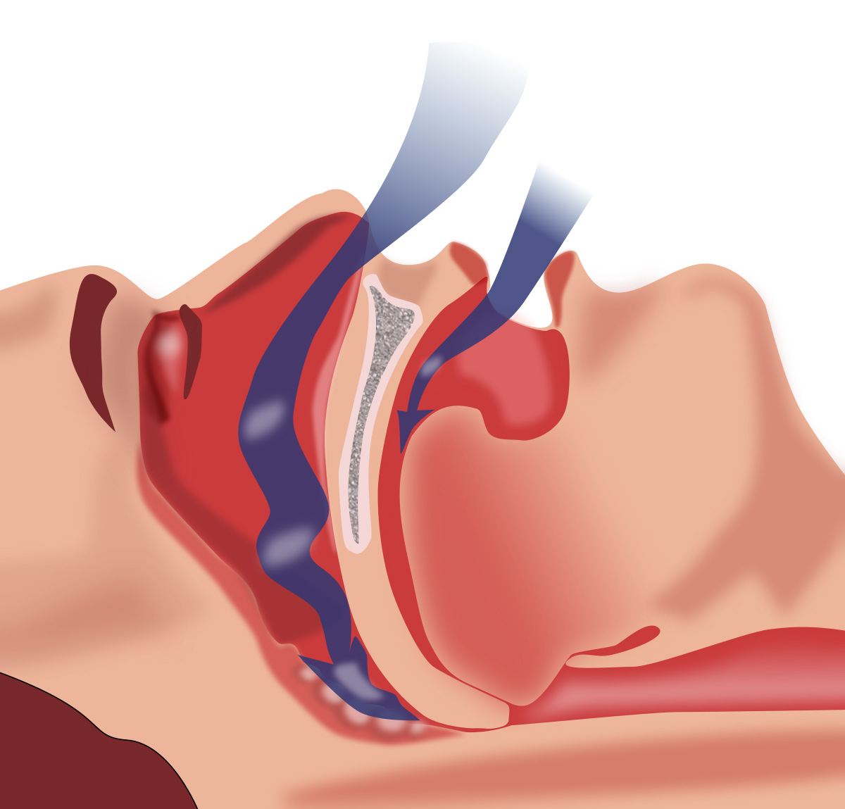 CAN SLEEP APNEA CONTROLLED BY MY DENTIST 2