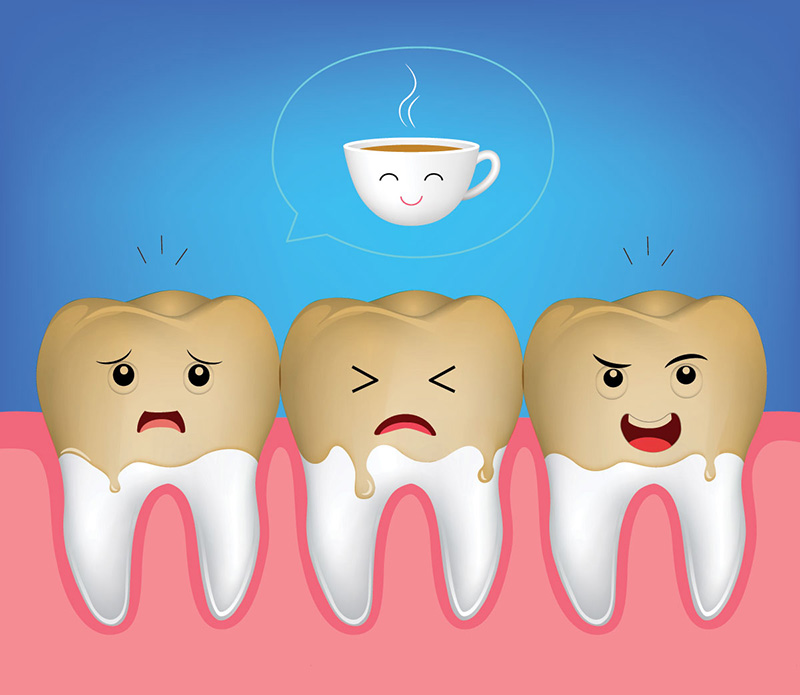 4 Causes of Yellow Teeth and How to Treat Them 2