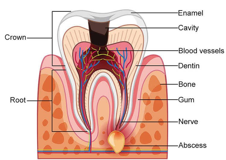 Top 8 indicators of tooth abscess Top 8 indicators of tooth abscess