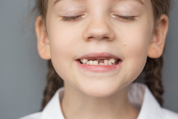 My child’s adult teeth coming in yellow - Why 2