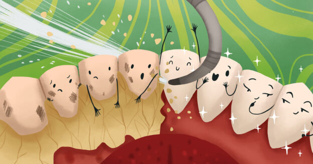 Top 5 ways to treat Dental Plaque 3 Top 5 ways to treat Dental Plaque 3