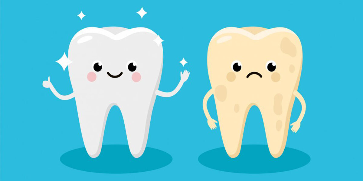 How To Fix Yellow Teeth