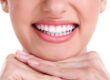 5 Ways To Maintain White Teeth Following A Whitening Procedure 1