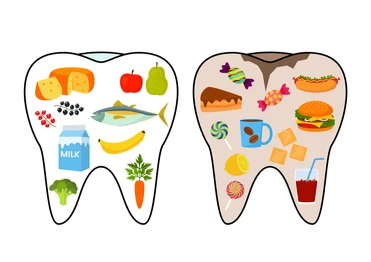 6 Important points about how your Diet affects your Dental Health 1