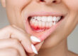 What Type of Toothpaste Is Good To Help Prevent Gum Disease1