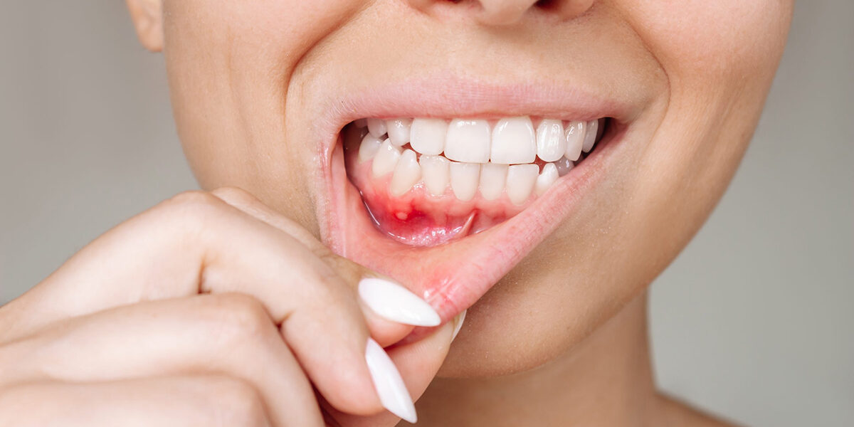 What Type of Toothpaste Is Good To Help Prevent Gum Disease1 What Type of Toothpaste Is Good To Help Prevent Gum Disease1