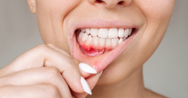 What Type of Toothpaste Is Good To Help Prevent Gum Disease1 What Type of Toothpaste Is Good To Help Prevent Gum Disease1