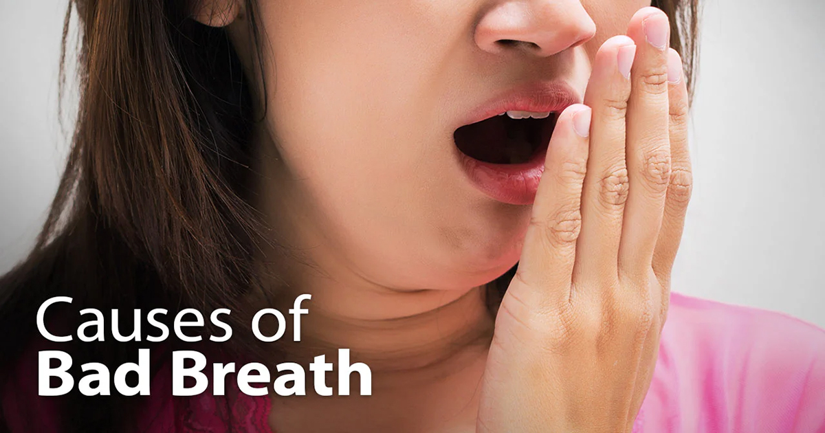 7 Common Causes of Bad Breath 1 copy 7 Common Causes of Bad Breath 1 copy